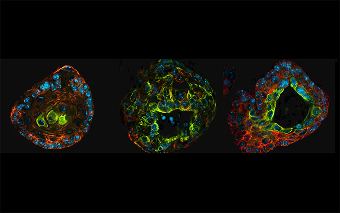 Prostate organoids