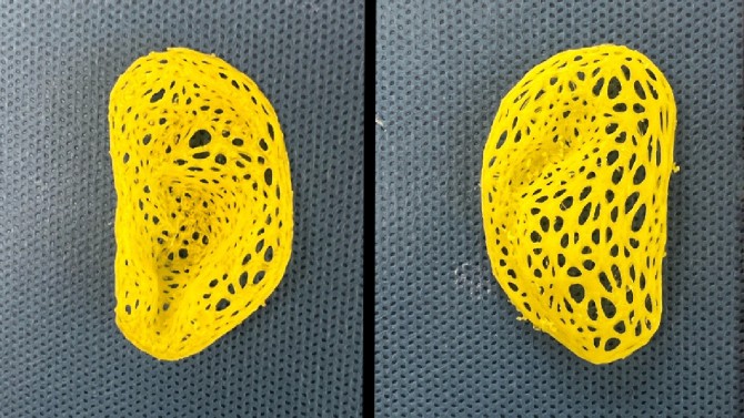 Pictured is the intricate, left-ear plastic scaffold (anterior view at left, posterior view at right) that was created on a 3D printer, based on data from a person’s ear.